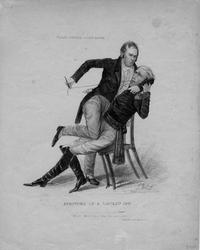 Sintomi di un blocco della mascella, c.1827 da American School