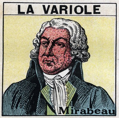 Ritratto di Honore Gabriel Riqueti, Conte di Mirabeau (1749-1791) con il volto segnato dal vaiolo. Per evitare cicatrici causate dal vaiolo, i pazienti dovrebbero essere trattati in stanze o entrare solo in luce rossa, priva di raggi ultravioletti. Illustr da Anonymous Anonymous