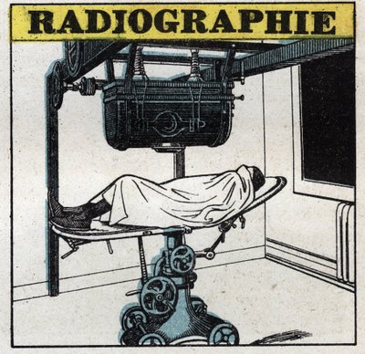 Raggi X: apparecchio a raggi X. Illustrazione anonima del 1925. Collezione privata. da Anonymous Anonymous