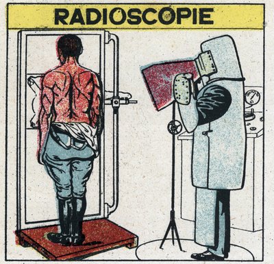 Raggi X: radioscopia di un corpo umano. Il radiologo si protegge dai raggi X indossando un panno di gomma con una dissoluzione di gomma contenente sali di piombo, la sua testa è coperta da un cappuccio e le sue mani da guanti dello stesso tessuto, i suoi o da Anonymous Anonymous