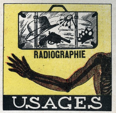 Raggi X: uso dei raggi X per vedere attraverso oggetti e corpi. Illustrazione anonima del 1925. Collezione privata. da Anonymous Anonymous