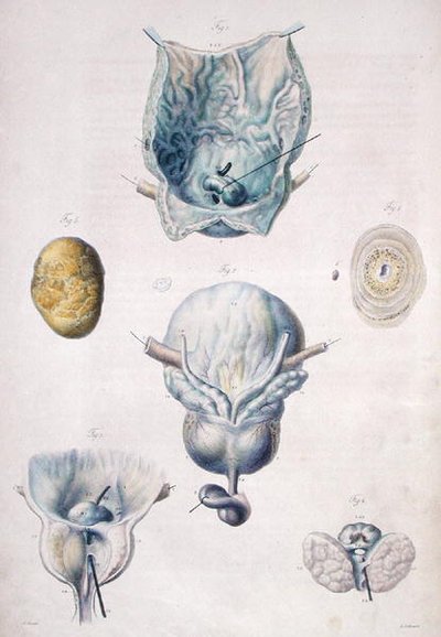 Malattie della vescica e della prostata, da 
