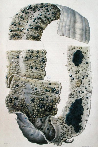 Malattie dell