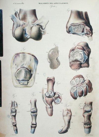 Malattie delle articolazioni, da 