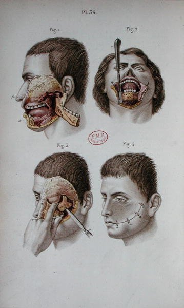Tavola anatomica della mascella superiore da C and Huette E. Bernard