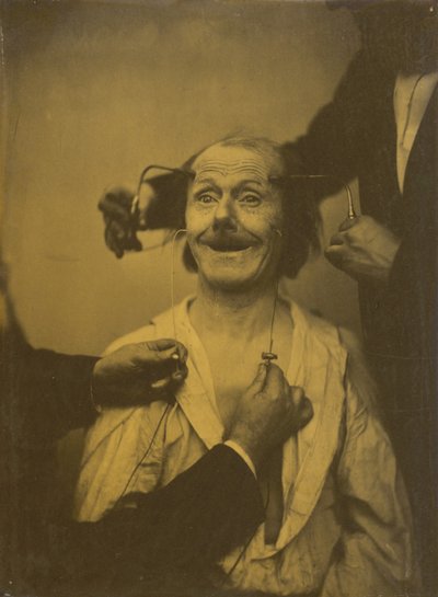 Una falsa, incompleta espressione di sorpresa piacevole o ammirazione, 1854-1856, stampato 1862 da Duchenne de Boulogne