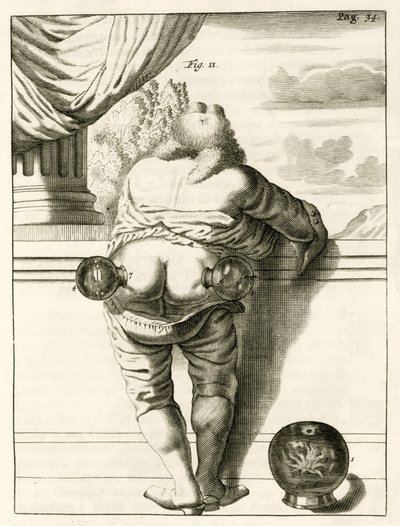 Un esempio di coppettazione, da Exercitationes Practicae circa Medendi Methodum di Frederik Dekkers, 1694 da Dutch School