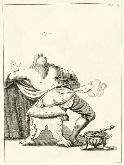 Incisione di un foruncolo sul fondo, da Exercitationes Practicae circa Medendi Methodum di Frederik Dekkers, 1694 da Dutch School