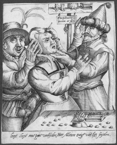 Trapanazione, inciso da H. Weydmans (XVI secolo) da Dutch School