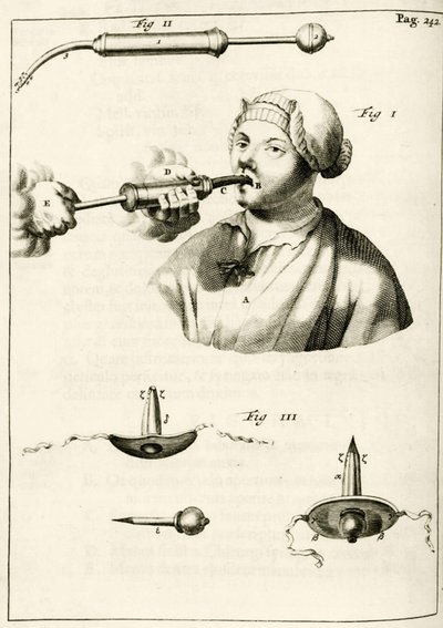 Uso di una siringa per somministrare un purgante, da Exercitationes Practicae circa Medendi Methodum di Frederik Dekkers, 1694 da Dutch School
