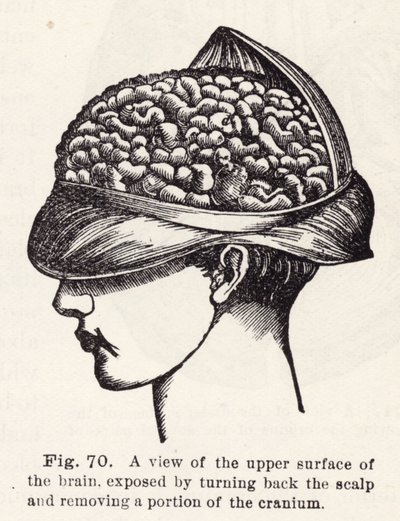 Vista della superficie superiore del cervello, esposta sollevando il cuoio capelluto e rimuovendo una parte del cranio (incisione) da English School