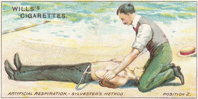 Respirazione artificiale, metodo Sylvester - Posizione 2, n.17 dalla serie di carte di sigarette di primo soccorso di Willss, 1913 da English School