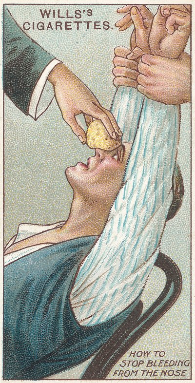Come fermare il sanguinamento dal naso, n.31 dalla serie di carte di sigarette di primo soccorso di Willss, 1913 da English School