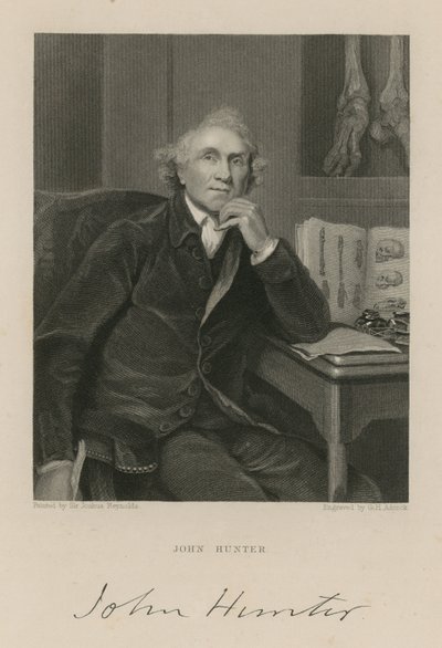 John Hunter da English School