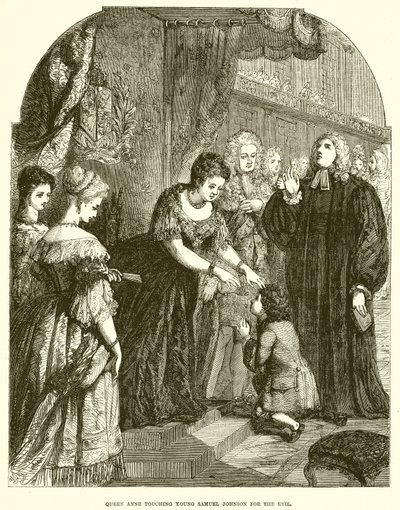 La Regina Anna tocca il giovane Samuel Johnson per il male da English School