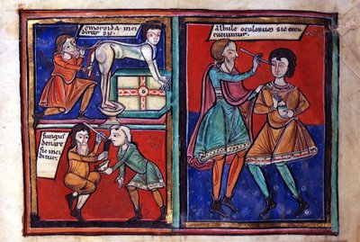 Sloane Ms 1975 fol.93 Operazioni mediche da English School