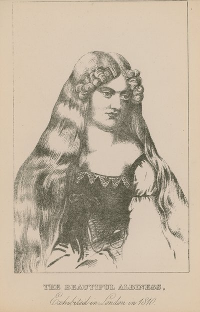 La bella albina, esposta a Londra nel 1810 da English School