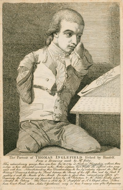 Thomas Inglefield, nato il 18 dicembre 1769 a Hook, Hampshire, senza braccia né gambe da English School