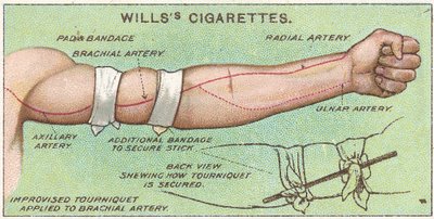 Laccio emostatico, n.11 dalla serie di carte di sigarette di primo soccorso di Willss, 1913 da English School