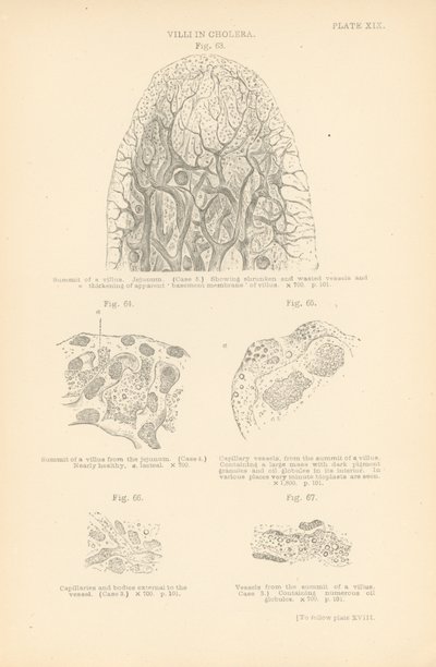 Villi nel colera (litografia a colori) da English School