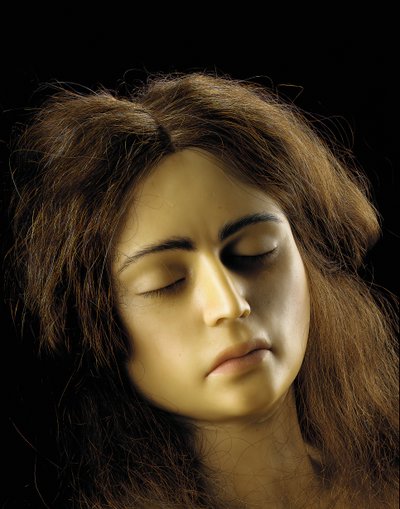 Modello anatomico di una gravidanza ovarica (dettaglio) da European School