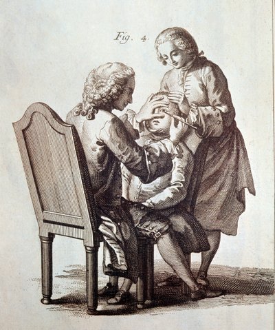 Un dottore che opera un paziente con cataratta, illustrazione dall