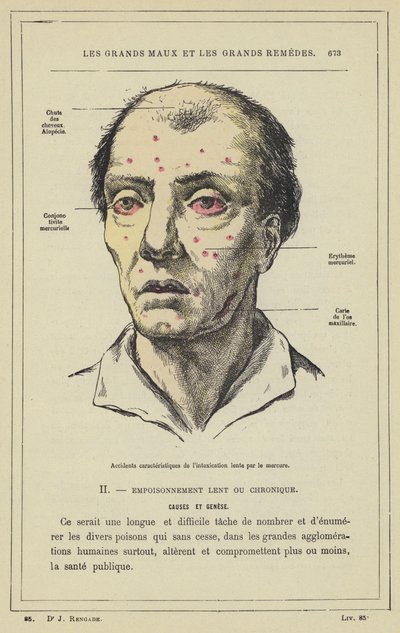 Incidenti caratteristici dell
