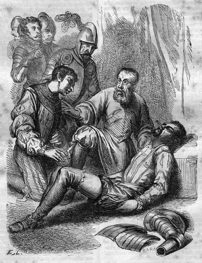 Ambroise Paré, chirurgo francese da French School
