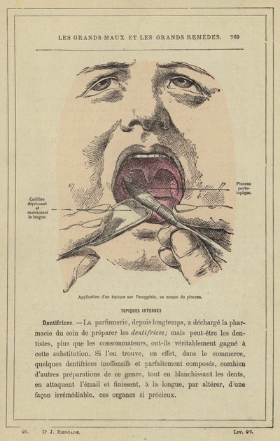 Applicazione di un topico sull