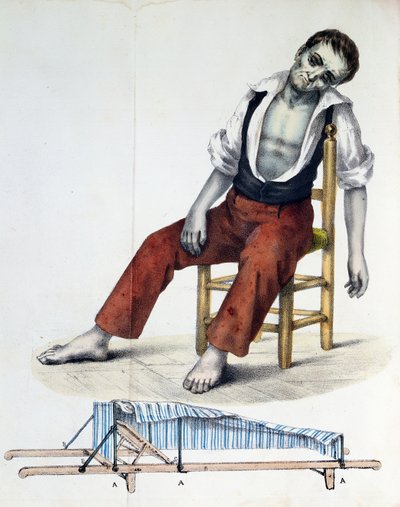 Cholera Morbus, da Relacao, Historica, Statistica e Medica da Cholera-Morbus di Francisco d