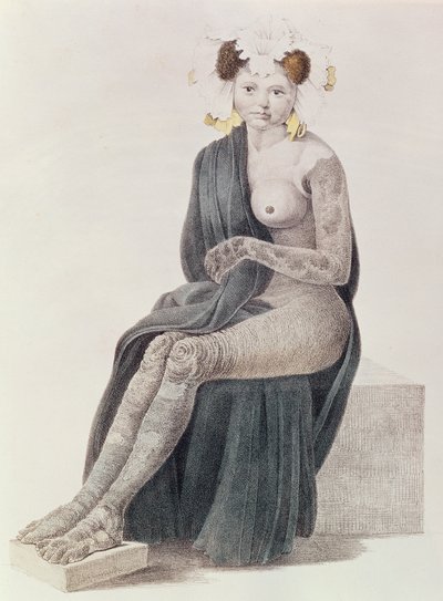 Ittiosi congenita, da un libro di G.M. Olbers, 1830 da French School