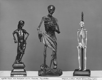Cadavere, scheletri da French School