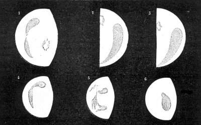 Macchie scure e luminose di Venere; 1, 2, 3, macchie osservate da D. Cassini nel 1667; 4, 5, 6, macchie osservate da M. Langdon nel 1871 - in 