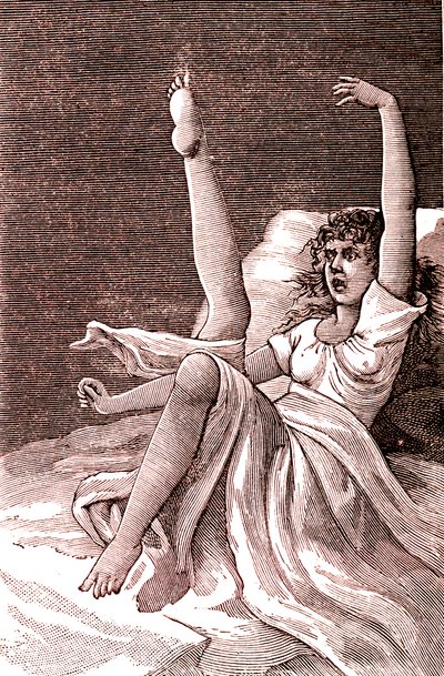 Isteria, un fenomeno mentale estremo, psicosi e psiconeurosi. 1887 da French School
