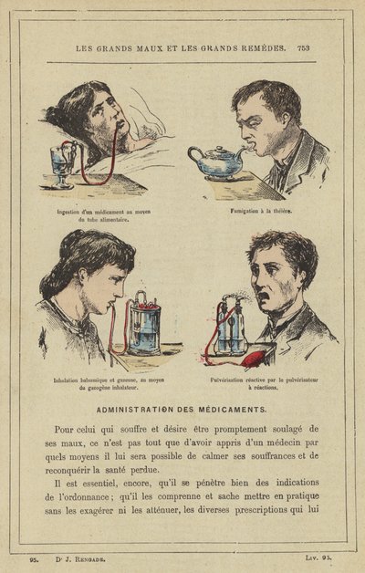 Ingestione di un medicinale mediante il tubo alimentare, fumigazione con la teiera, inalazione balsamica e gassosa, mediante l