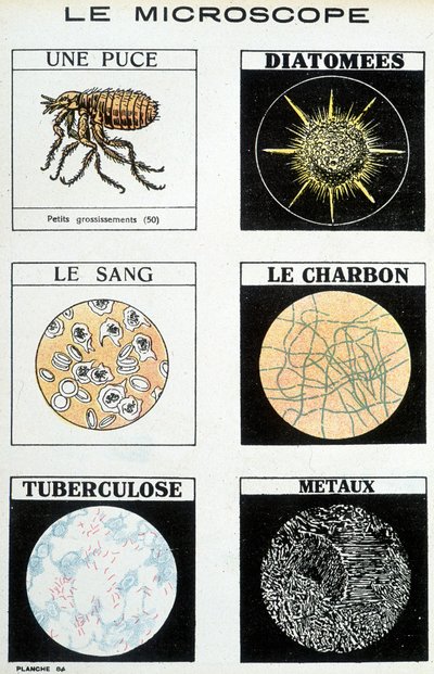 Microscopi: una pulce, diatomee, sangue, carbone, tubercolosi, metalli da French School