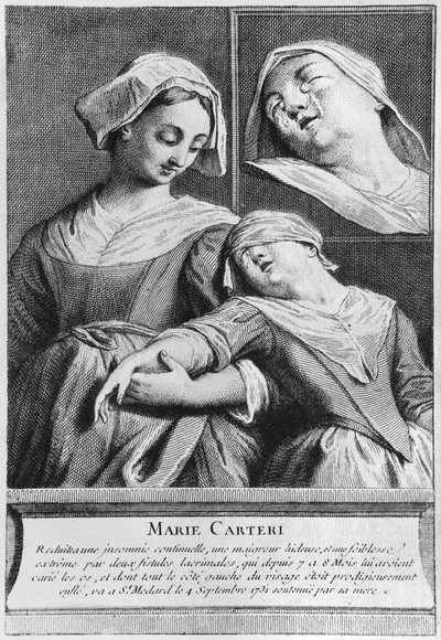 Guarigione miracolosa di una donna cieca, Marie Carteri, sulla tomba del diacono Francois de Paris al cimitero parrocchiale di Saint-Medard a Parigi da French School