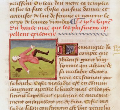 Ms 22532 Paziente che soffre di un attacco epilettico, da Le Livre des Proprietes des choses di Barthelemy l