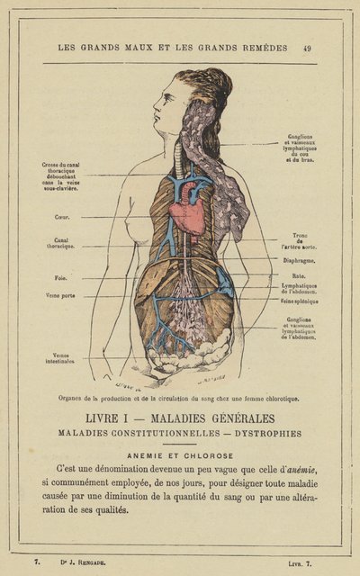 Organi della produzione e della circolazione del sangue in una donna clorotica (litografia a colori) da French School