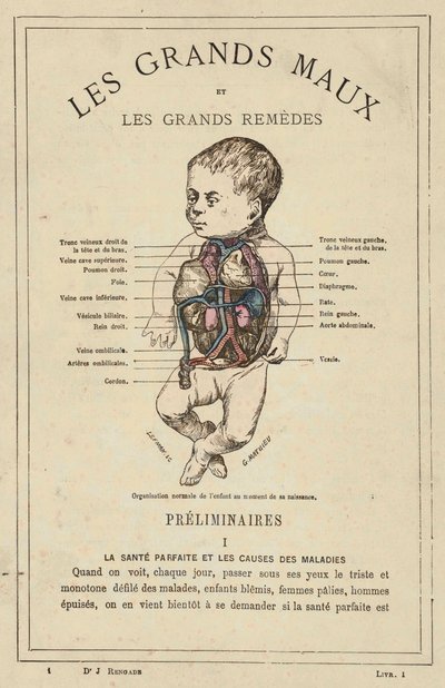 Organizzazione normale del bambino al momento della nascita da French School