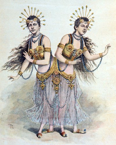 Gemelle siamesi, Rosa e Josepha Blazek Da "Le Petit Journal", Parigi, 8 aprile 1891 (incisione) da French School