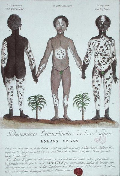 Il fenomeno della leucoderma da French School