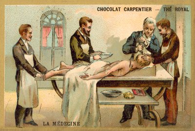 Trapanazione da French School