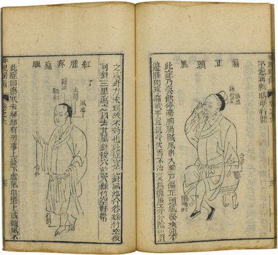 Shen Shi Yao Han Un prezioso libro di oftalmologia da Fu Renyu