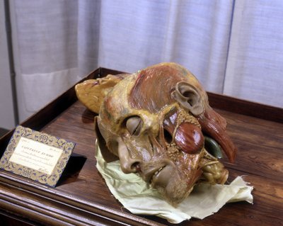 Immagine sconosciuta da Gaetano Giulio Zumbo