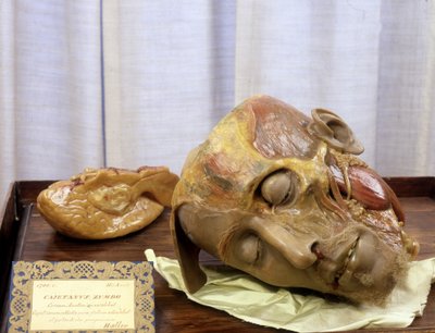 Immagine sconosciuta da Gaetano Giulio Zumbo