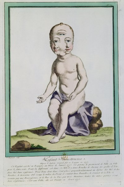 Bambino con testa deformata, da 