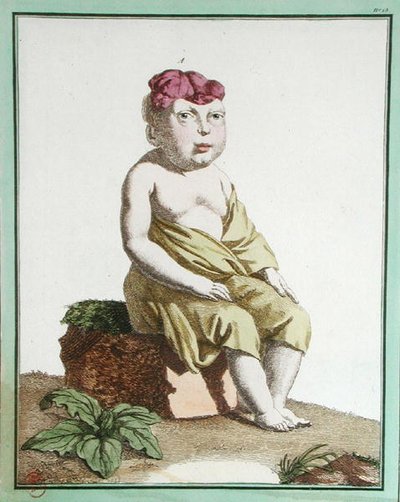Bambino con metà testa, da 