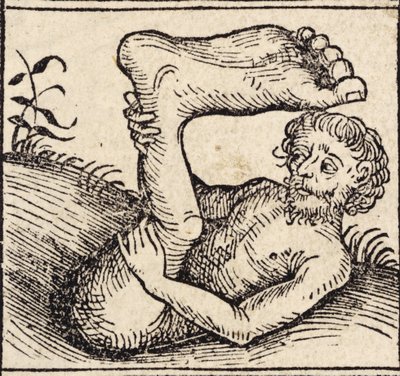 Un sciopode, Uomo con un piede gonfio, da 