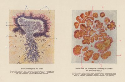 Actinomyces bovis da German School